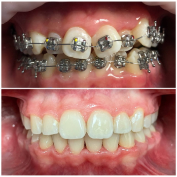 hrechkovskyi-orthodontics-services hrechkovskyi-orthodontics-services